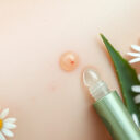 Punktowe sposoby na pryszcza domowe – wybór produktu i stosowanie: nawilżenie i mniej podrażnień w praktyce