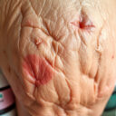 Inflammaging co to – przewodnik dla początkujących: od czego zacząć i czego unikać